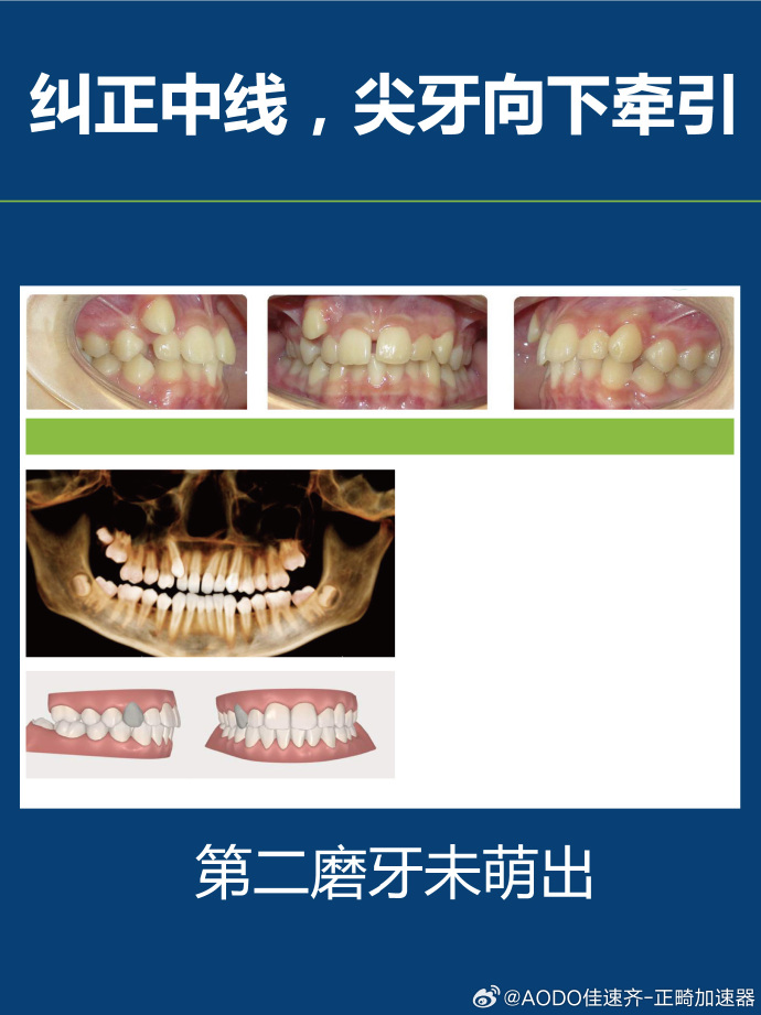 怎么矫正客户端时间豫在矫社区矫正客户端